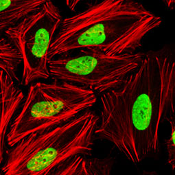 KAP1 antibody [N3C2], Internal (GTX102226)